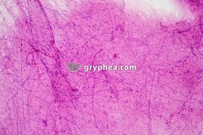 Réseau fibres nerveuses ME x25 - gryphea.com